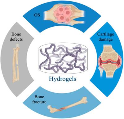 Therapeutic application of hydrogels for bone-related diseases